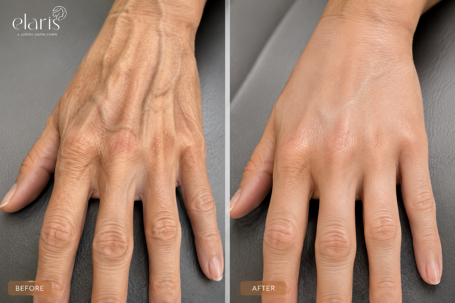 Skin rejuvenation Dubai Elaris