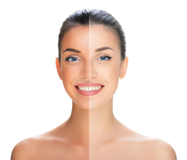 Skin brightening Dubai Elaris